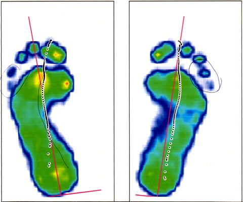 adidas-footscan